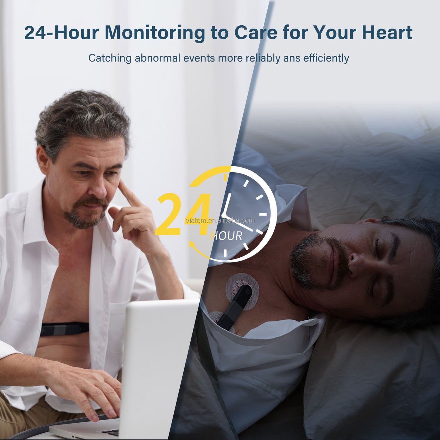 Portable Bluetooth Ecg Monitor Single-lead 24-hour Monitoring Real-time Ecg/ekg Tracking Via App Health Monitor Ecg