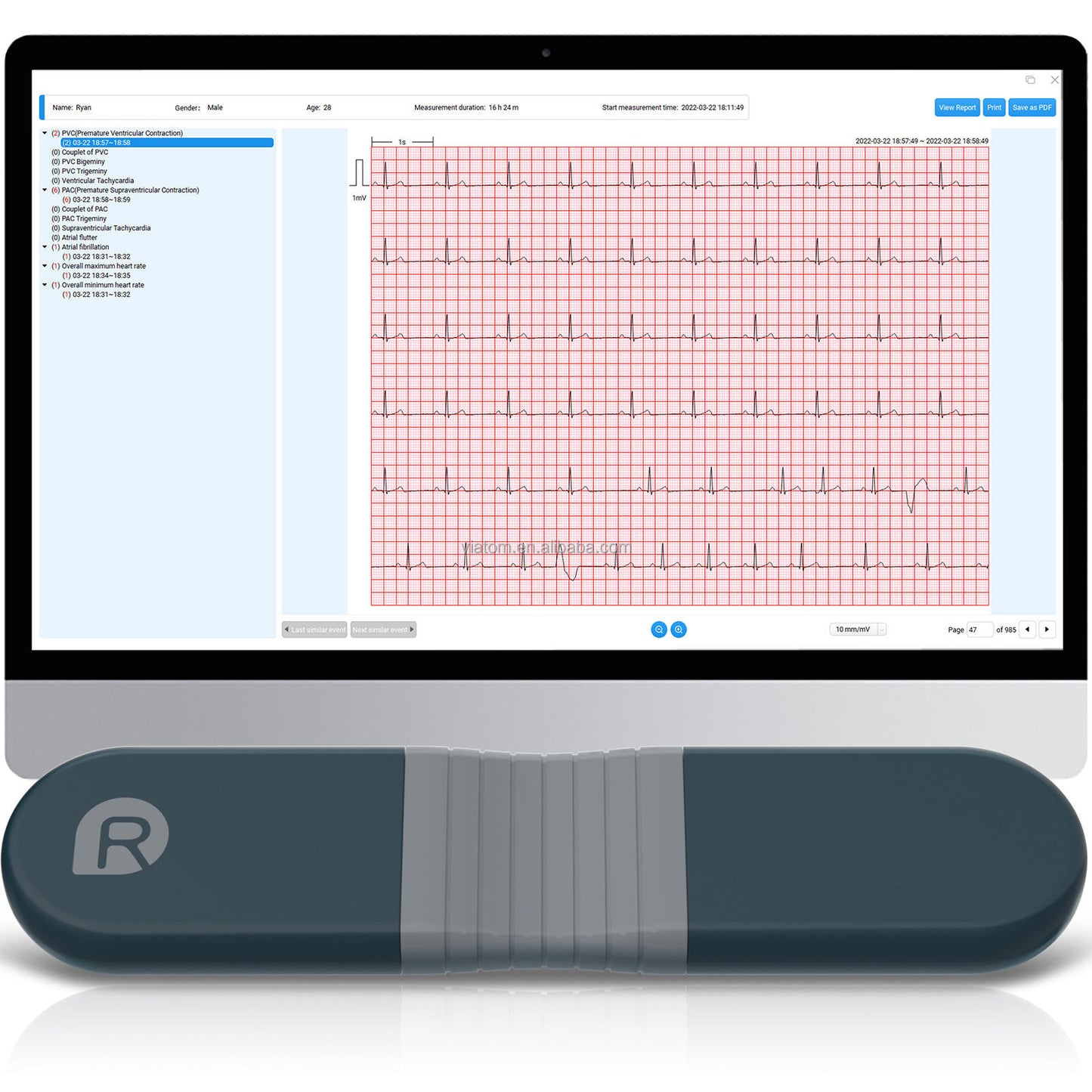 Portable Bluetooth Ecg Monitor Single-lead 24-hour Monitoring Real-time Ecg/ekg Tracking Via App Health Monitor Ecg